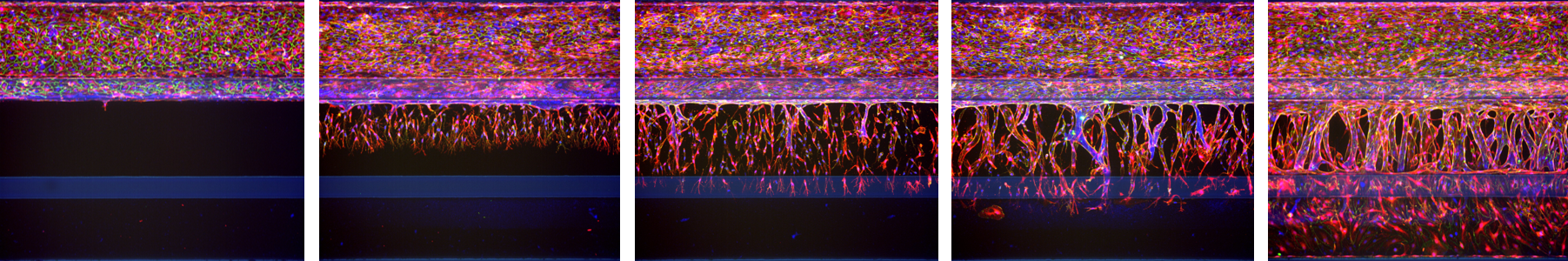 Angiogenic sprouting in the OrganoPlate